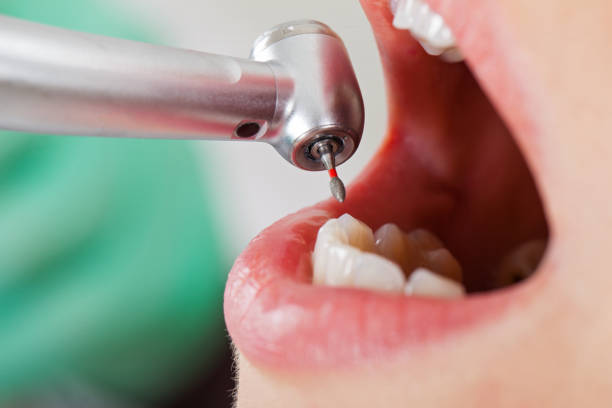 Best Emergency Treatment for Oral Infections in Fairdale, PA